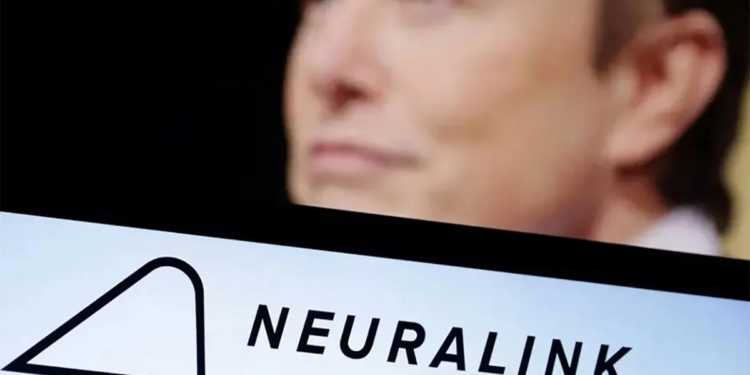 Anuncia Elon Musk exitoso implante de un chip cerebral en humanos Anuncia Elon Musk exitoso implante de un chip cerebral en humanos